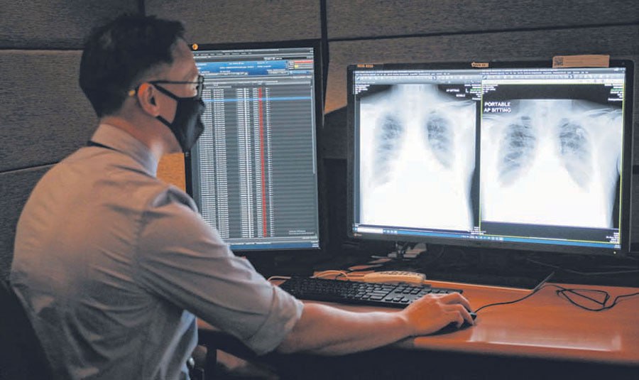 AI-Powered Chest X-Rays Catch Hidden Lung Cancer Risks — Even When No One’s Looking