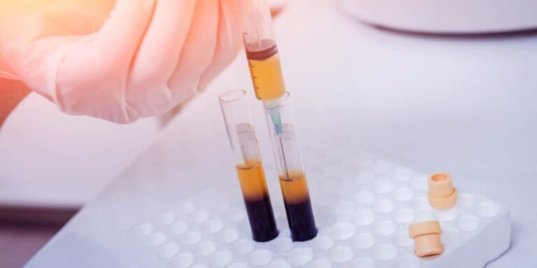 خطر ناشی از پلاسما فروشی در بخش خصوصی